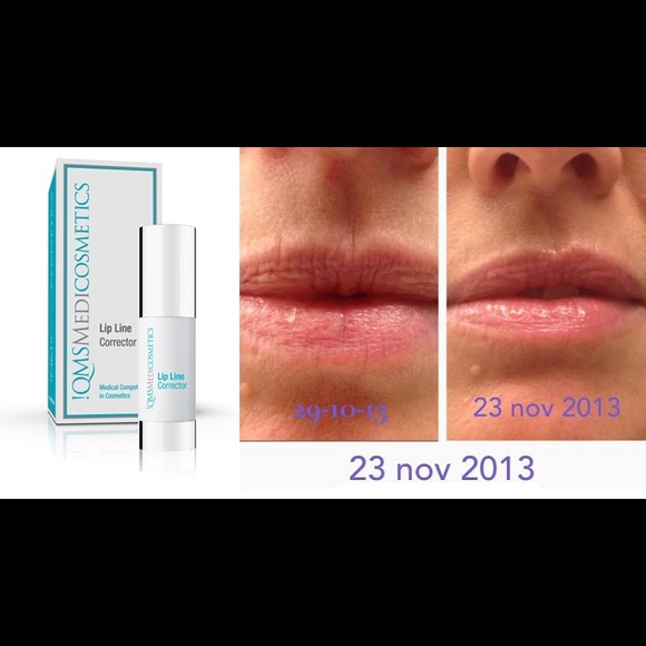 NWT QMS Medicosmetics Lip Line Corrector - Picture 3 of 3